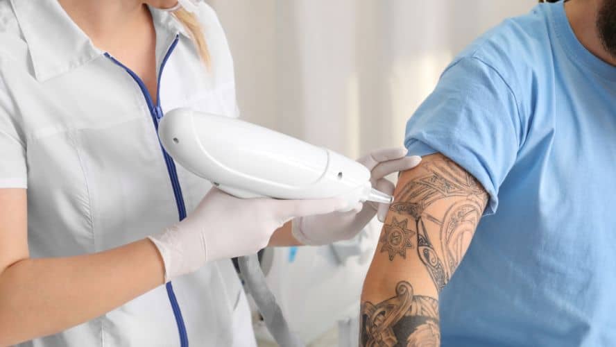 Pros and Cons of Tattoo Removal