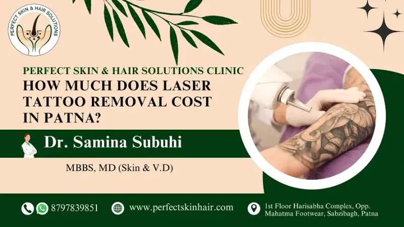 Tattoo removal in patna