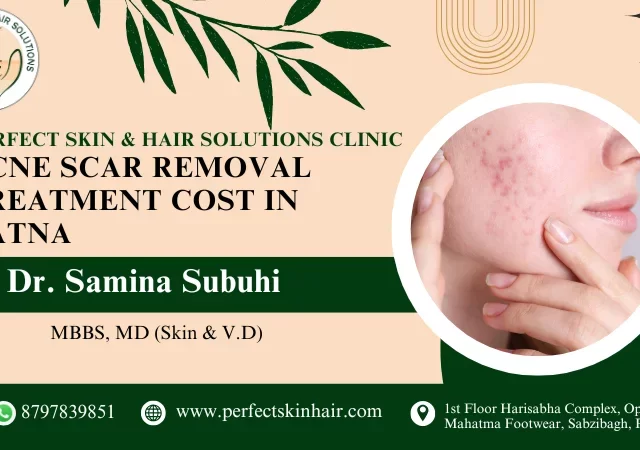 Acne scar removal treatment in patna