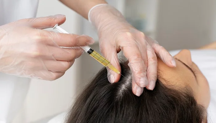 prp treatment for hair