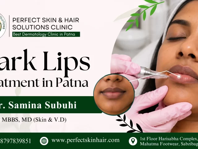 Dark Lips Treatment in Patna