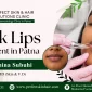 Dark Lips Treatment in Patna