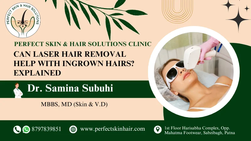 Laser Hair Removal for Ingrown Hairs