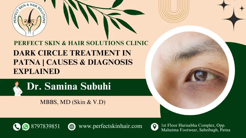 Dark Circle Treatment in Patna
