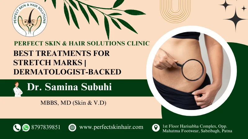 Best Treatments for Stretch Marks