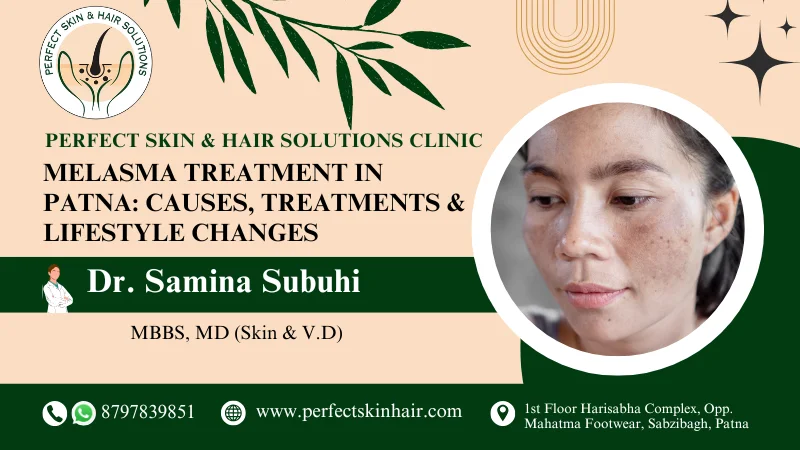melasma treatment in patna