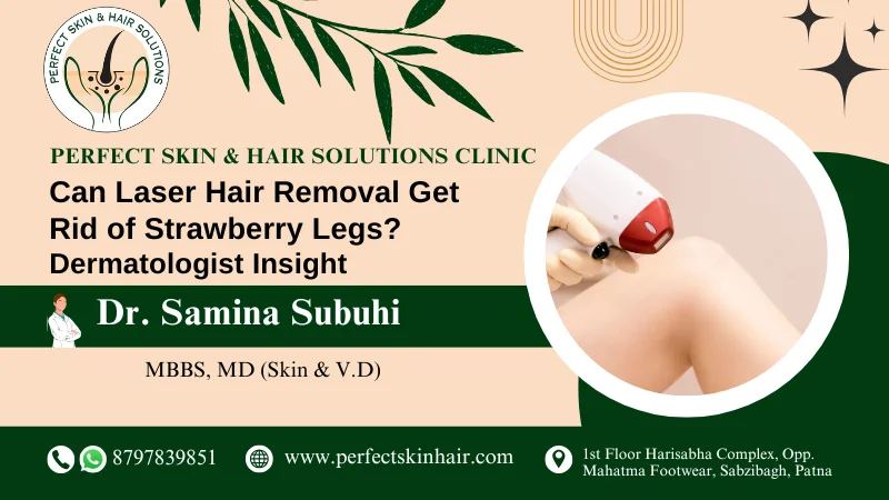 Laser Hair Removal for Strawberry Legs