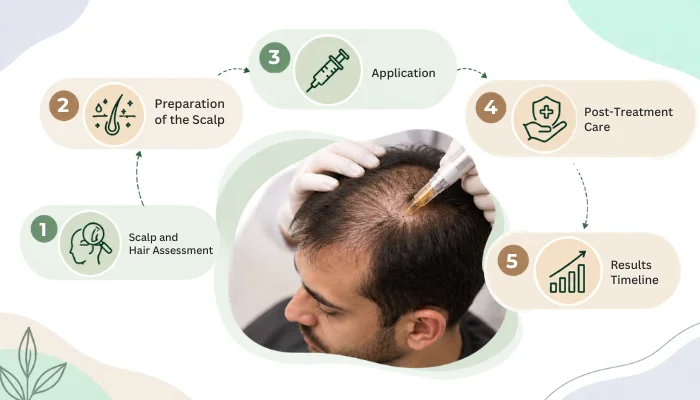 How Does Exosome Therapy Work for Hair Loss?