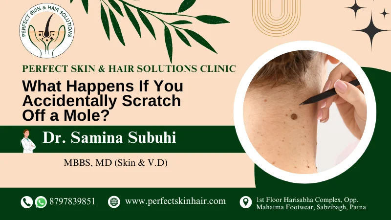 What Happens If You Accidentally Scratch Off a mole