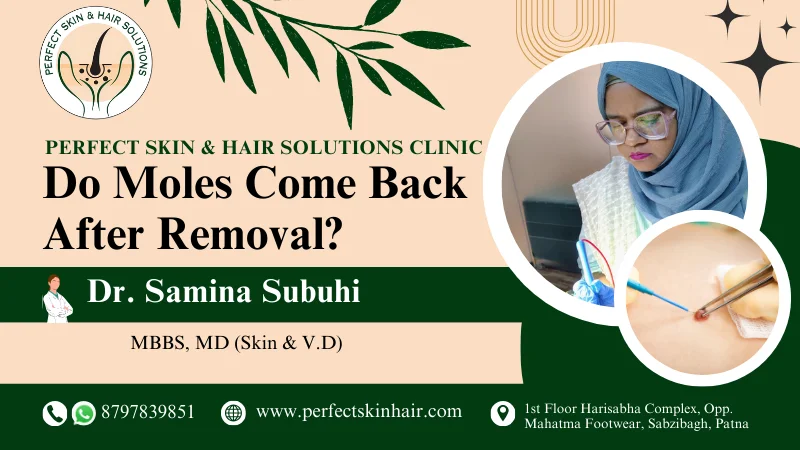 Do Moles Grow Back After Removal