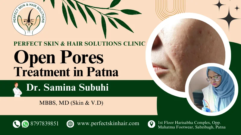 Open Pores Treatment in Patna