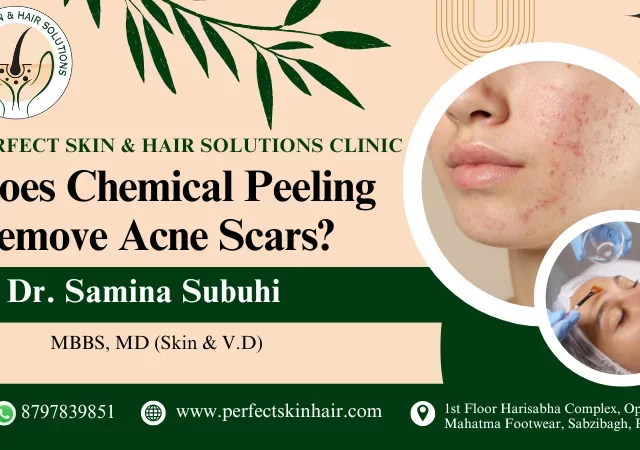 Does Chemical Peeling Remove Acne Scars