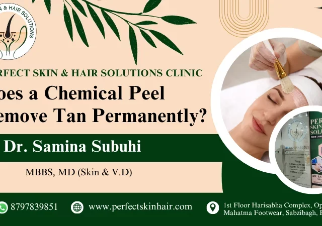 Does Chemical Peel Remove Tan?