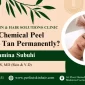 Does Chemical Peel Remove Tan?