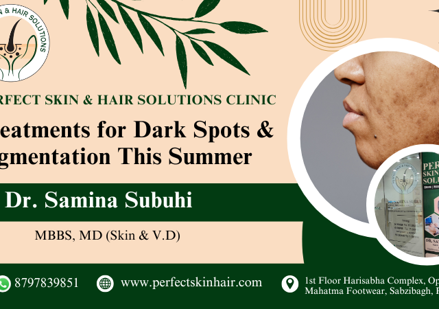 Top 3 Professional Treatments for Dark Spots & Pigmentation This Summer