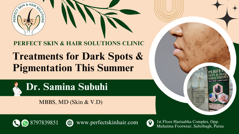 Top 3 Professional Treatments for Dark Spots & Pigmentation This Summer