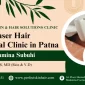 Laser Hair Removal Clinic in Patna