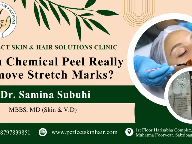Can Chemical Peel Remove Stretch Marks