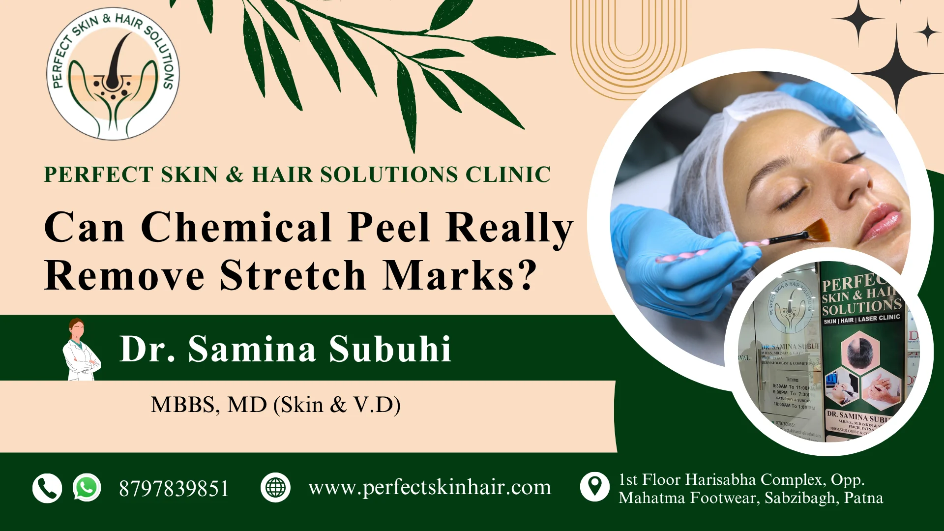 Can Chemical Peel Remove Stretch Marks