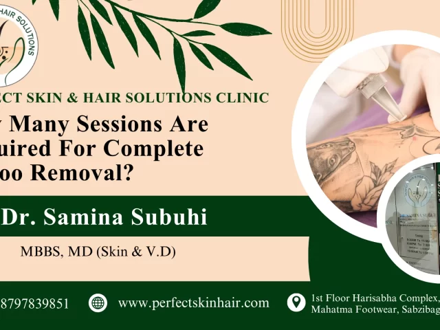 How many sessions are required for complete tattoo removal
