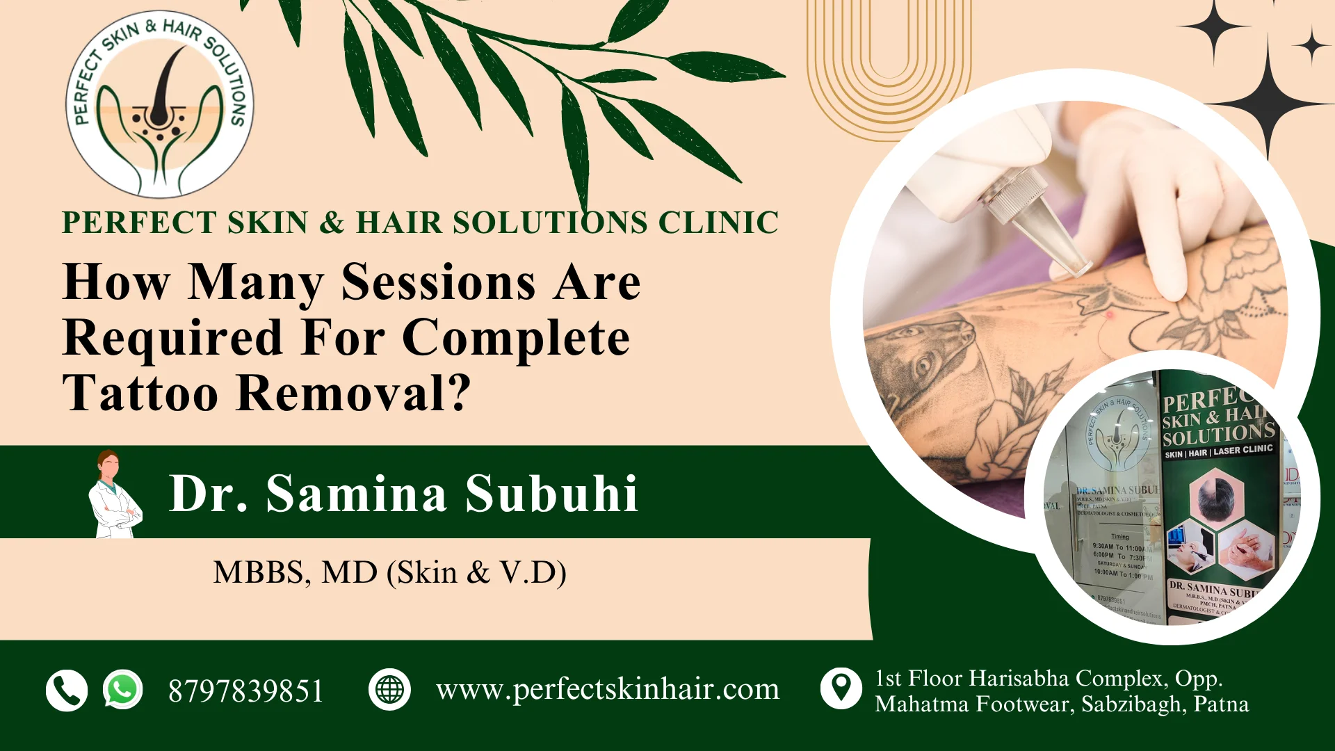 How many sessions are required for complete tattoo removal