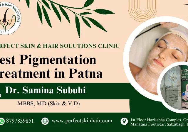 pigmentation treatment in patna