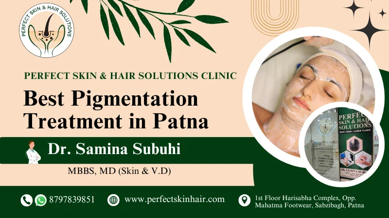 pigmentation treatment in patna