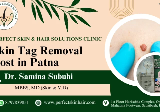 Skin Tag Removal Cost in Patna