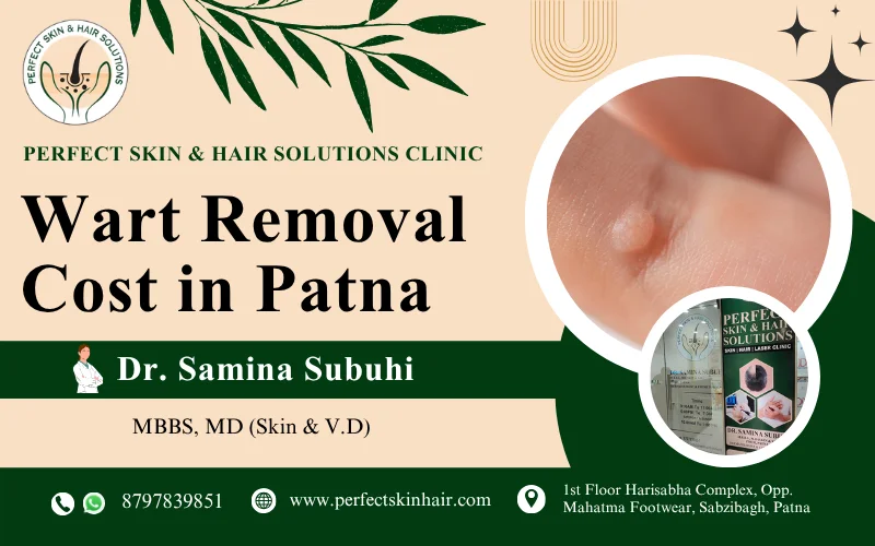 Wart Removal Cost in Patna