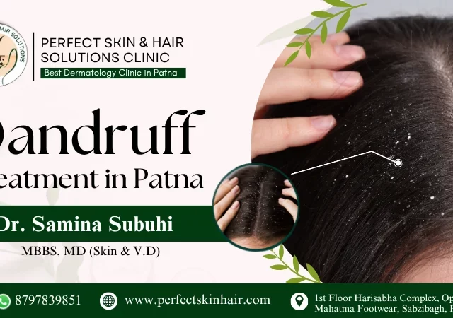 what causes dandruff