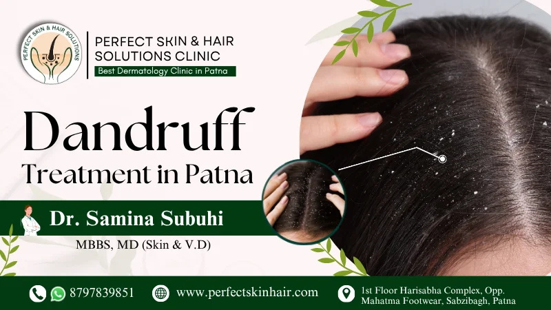 what causes dandruff