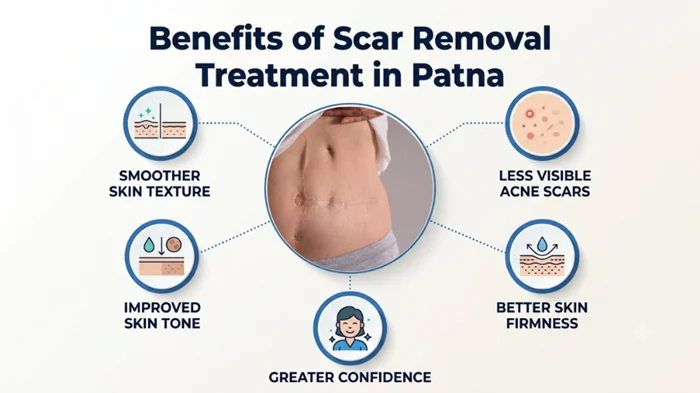 Benefits of Scar Removal Treatment in Patna