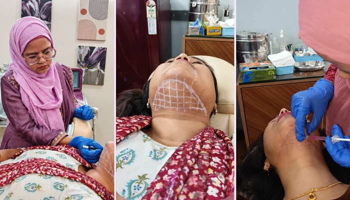 Double Chin Removal Treatment by Samina Subuhi