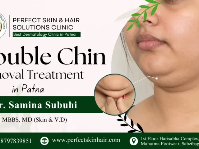 Double Chin Removal Treatment in Patna