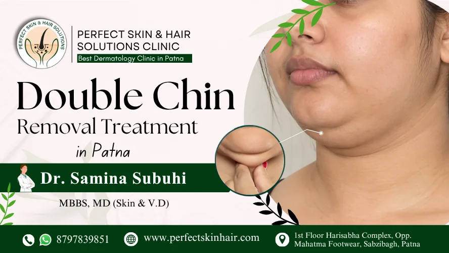 Double Chin Removal Treatment in Patna
