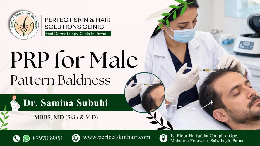 PRP for male pattern baldness