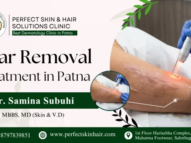 Scar Removal Treatment in Patna