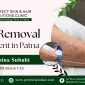 Scar Removal Treatment in Patna