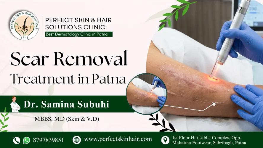 Scar Removal Treatment in Patna