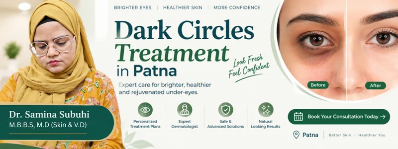 dark circles removal