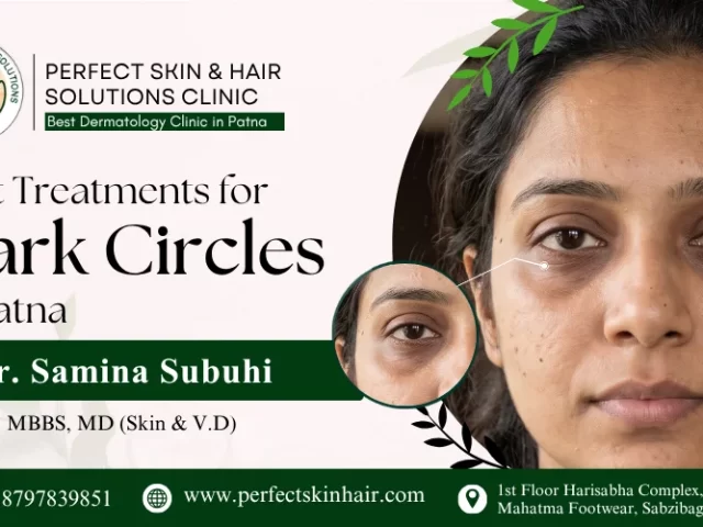 Best Treatments for Dark Circles in Patna