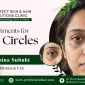Best Treatments for Dark Circles in Patna